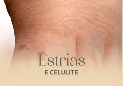 ESTRIAS