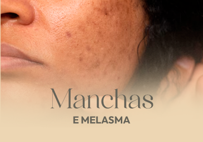 manchas