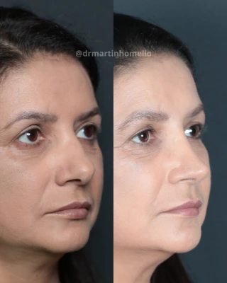 IMG_5234